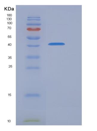 Recombinant Human PRMT6 / HRMT1L6 Protein (His & FLAG tag),Recombinant Human PRMT6 / HRMT1L6 Protein (His & FLAG tag)