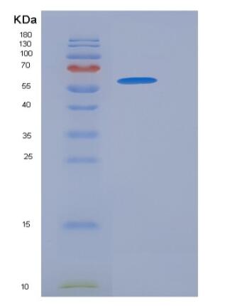 Recombinant Human CD93 / C1QR1 Protein (His tag),Recombinant Human CD93 / C1QR1 Protein (His tag)