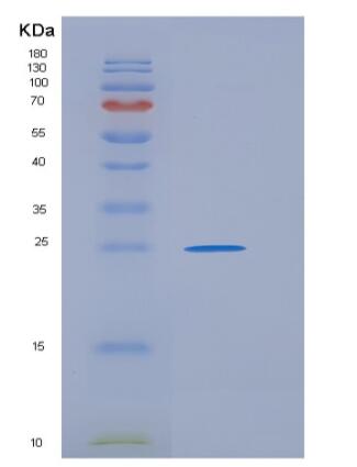 Recombinant Mouse GPA33 / Glycoprotein A33 Protein (His tag),Recombinant Mouse GPA33 / Glycoprotein A33 Protein (His tag)