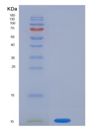 Recombinant Human S100P / S100E Protein,Recombinant Human S100P / S100E Protein