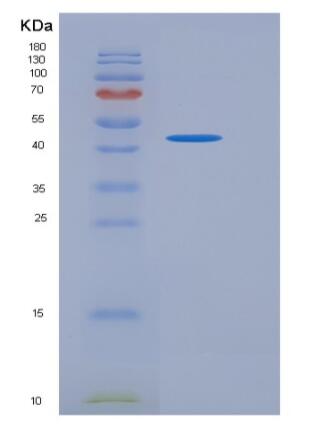 Recombinant Human NEIL1 Protein (His tag),Recombinant Human NEIL1 Protein (His tag)