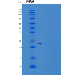 Recombinant Mouse CHODL / Chondrolectin Protein (His tag),Recombinant Mouse CHODL / Chondrolectin Protein (His tag)