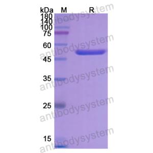 Recombinant Human SERPINF2, N-His