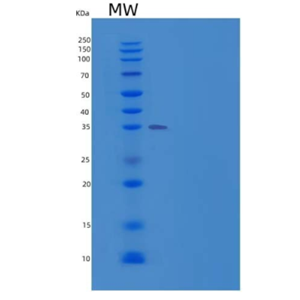 Recombinant Human ACP5 / TRAP Protein (His tag)
