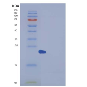 Recombinant Human Peroxiredoxin 2 / PRDX2 Protein (His tag)