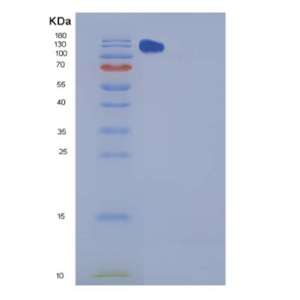 Recombinant Mouse CHL-1 Protein (Fc tag)