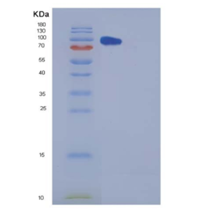 Recombinant Human Carboxypeptidase E / CPE Protein (Fc tag),Recombinant Human Carboxypeptidase E / CPE Protein (Fc tag)