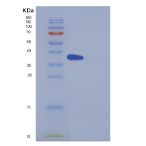 Recombinant Mouse IL5Ra / CD125 Protein (His tag),Recombinant Mouse IL5Ra / CD125 Protein (His tag)