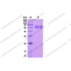 重组CD126/IL6R/IL-6RA蛋白,Recombinant Human CD126/IL6R/IL-6RA, C-His