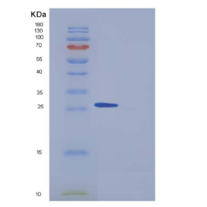 Recombinant Human PPM1G / PP2C-gamma Protein (aa 317-546, His tag),Recombinant Human PPM1G / PP2C-gamma Protein (aa 317-546, His tag)