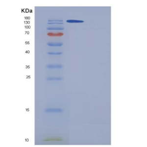 Recombinant Human A2M / CPAMD5 / Alpha-2-macroglobulin Protein (His tag)