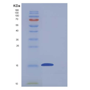 Recombinant Mouse CD7 Protein (His tag),Recombinant Mouse CD7 Protein (His tag)