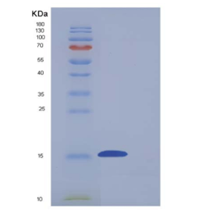 Recombinant Mouse CD7 Protein (His tag)