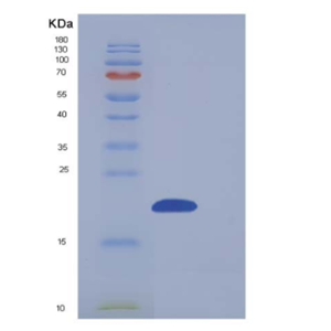 Recombinant Human NUDT2 / Ap4A hydrolase Protein (His tag)