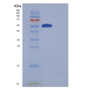 Recombinant Human SMYD3 / ZMYND1 Protein (His & FLAG tag)