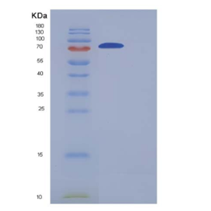 Recombinant Human GLT25D2 Protein (His tag),Recombinant Human GLT25D2 Protein (His tag)