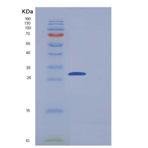 Recombinant Human Carbonic Anhydrase III / CA3 Protein (His tag)
