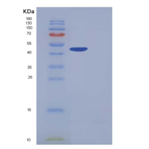 Recombinant Human Carboxypeptidase B1 / CPB1 Protein (His tag)