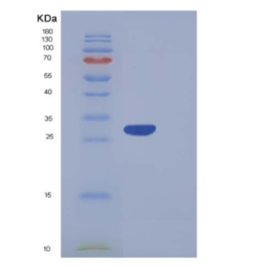 Recombinant Human CA5A / CA-VA Protein (His tag),Recombinant Human CA5A / CA-VA Protein (His tag)