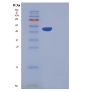 Recombinant Human Carboxypeptidase A2 / CPA2 Protein (His tag),Recombinant Human Carboxypeptidase A2 / CPA2 Protein (His tag)