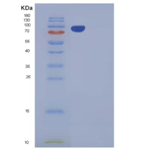 Recombinant Mouse CDCP1 Protein (Fc tag)