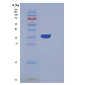 Recombinant Human PRRG2 Protein (Fc Tag)