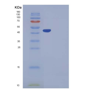 Recombinant Mouse Serpinb6b Protein (His tag),Recombinant Mouse Serpinb6b Protein (His tag)
