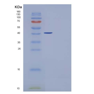 Recombinant Human PLA2G2D / Phospholipase A2 IID Protein (Fc tag)