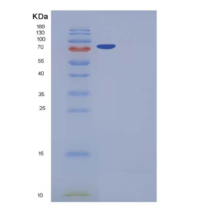 Recombinant Human DNMT2 / TRDMT1 Protein (GST tag),Recombinant Human DNMT2 / TRDMT1 Protein (GST tag)