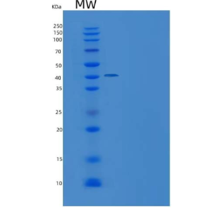 Recombinant Human NCR3 / NKp300 Protein (His & Fc tag),Recombinant Human NCR3 / NKp300 Protein (His & Fc tag)