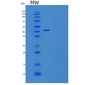 Recombinant Human C1D Protein (GST tag)