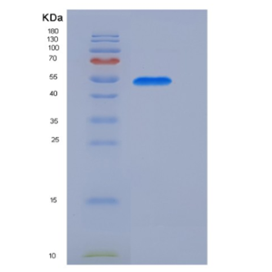 Recombinant Mouse Coagulation Factor IX / FIX / F9 Protein (His tag),Recombinant Mouse Coagulation Factor IX / FIX / F9 Protein (His tag)