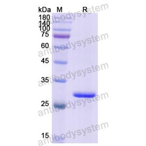 重组QDPR蛋白,Recombinant Human QDPR, N-His