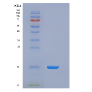 Recombinant Human CD164 / Endolyn Protein (His tag)