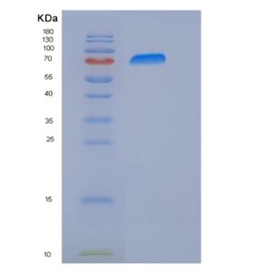 Recombinant Human PARP-3 / PARP3 Protein (His & GST tag)