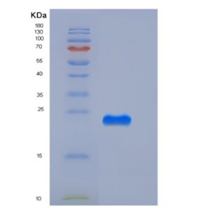 Recombinant Mouse CREG / CREG1 Protein (His tag),Recombinant Mouse CREG / CREG1 Protein (His tag)