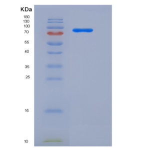 Recombinant Human AKT3 Protein (GST tag)