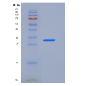 Recombinant Human Carbonic Anhydrase XIV / CA14 Protein (His tag)