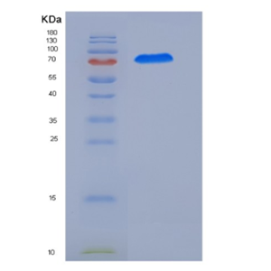 Recombinant Human CAMKV Protein (His & GST tag)