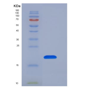 Recombinant Human GKN1 / Gastrokine 1 Protein (His tag)