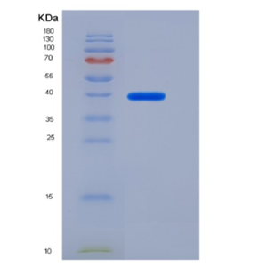 Recombinant Rat IL-6R / CD126 Protein (ECD, His tag)