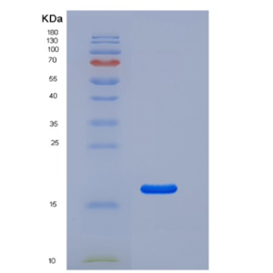 Recombinant Human CD69 Protein (His tag),Recombinant Human CD69 Protein (His tag)