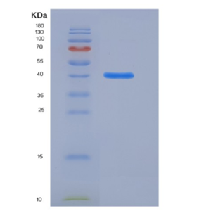 Recombinant Mouse HDAC8 / HDACL1 Protein (His tag),Recombinant Mouse HDAC8 / HDACL1 Protein (His tag)