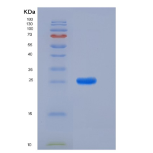 Recombinant Rat PRL8A4 Protein (His Tag)