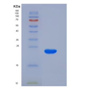 Recombinant Human K-Ras / K-Ras Protein (His tag),Recombinant Human K-Ras / K-Ras Protein (His tag)
