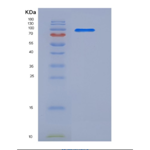 Recombinant Human SRPK1 Protein (His & GST tag)
