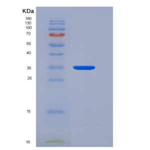 Recombinant Human ANXA5 / Annexin Ⅴ / Annexin A5 Protein
