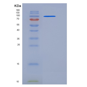 Recombinant Mouse ACO2 / Aconitase 2 Protein (His & GST tag),Recombinant Mouse ACO2 / Aconitase 2 Protein (His & GST tag)