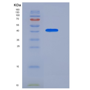 Recombinant Human APOA4 Protein (His Tag)