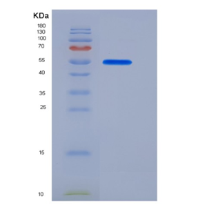 Recombinant Human PLTP Protein (His tag),Recombinant Human PLTP Protein (His tag)